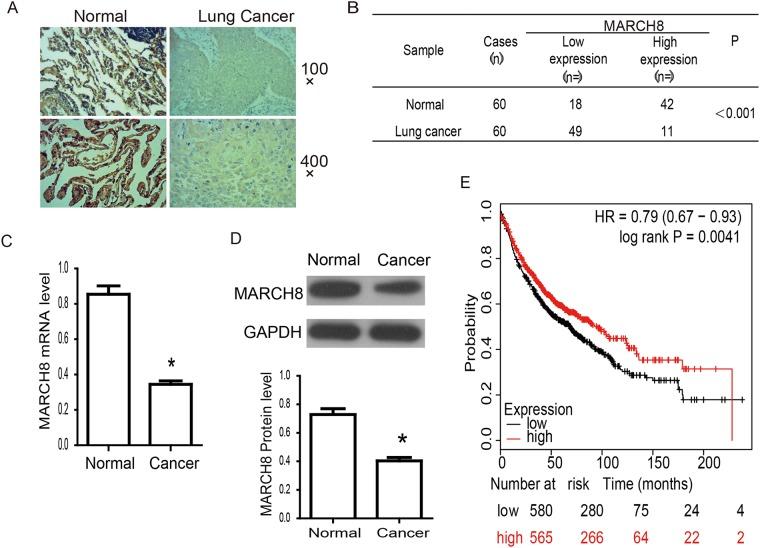 https://cdn.ncbi.nlm.nih.gov/pmc/blobs/165a/5746139/37e399c04f11/oncotarget-08-108238-g002.jpg