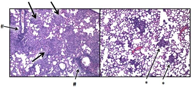 https://cdn.ncbi.nlm.nih.gov/pmc/blobs/1660/5681489/1ae2d9b522f1/fimmu-08-01438-g007.jpg