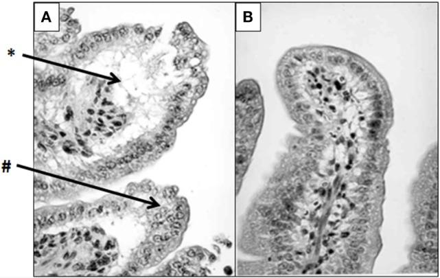 https://cdn.ncbi.nlm.nih.gov/pmc/blobs/1660/5681489/b1ca87110918/fimmu-08-01438-g005.jpg