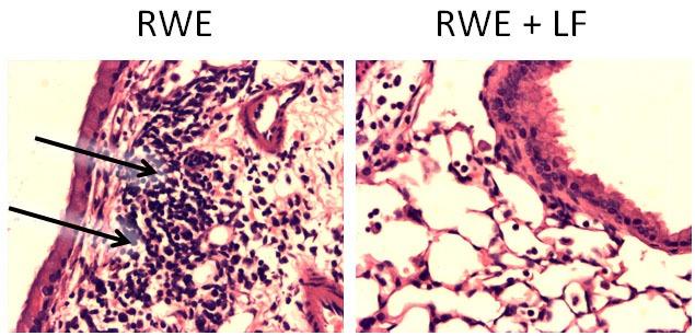 https://cdn.ncbi.nlm.nih.gov/pmc/blobs/1660/5681489/ccfcf13de793/fimmu-08-01438-g006.jpg