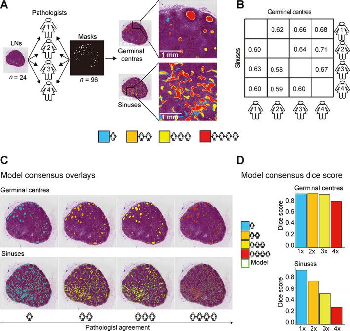 https://cdn.ncbi.nlm.nih.gov/pmc/blobs/1665/10720675/762f41cd9d63/PATH-260-376-g005.jpg