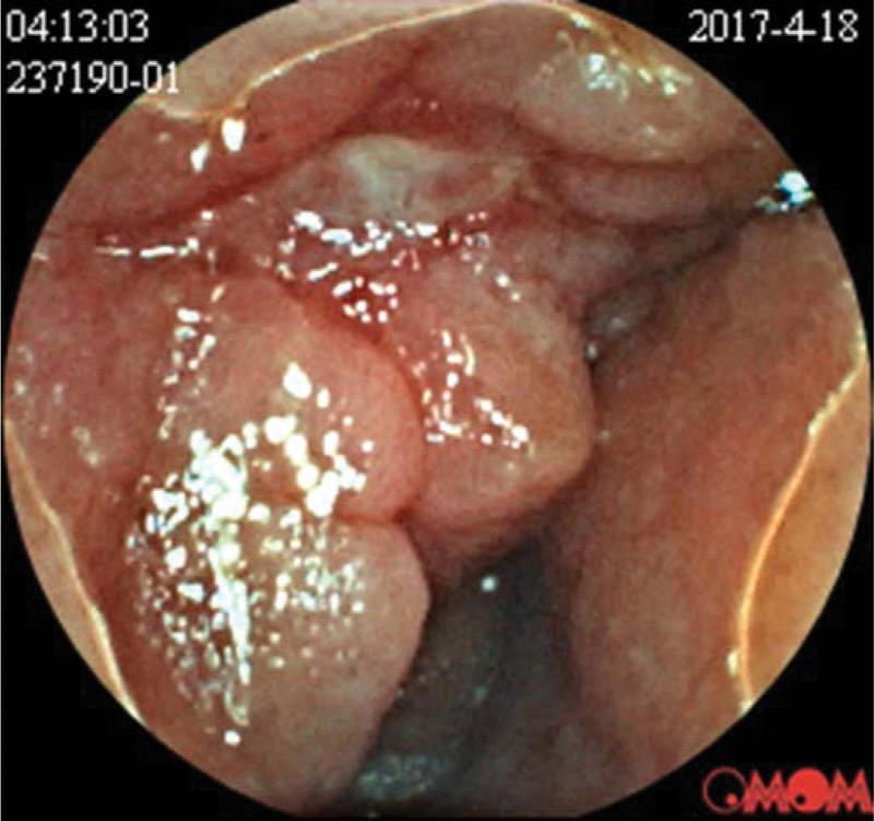 https://cdn.ncbi.nlm.nih.gov/pmc/blobs/1682/9592269/caff01c8bfdb/medi-101-e31163-g001.jpg