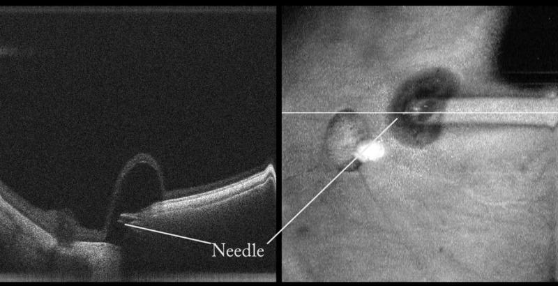 https://cdn.ncbi.nlm.nih.gov/pmc/blobs/1686/8212437/458a0b13f469/tvst-10-7-24-f004.jpg