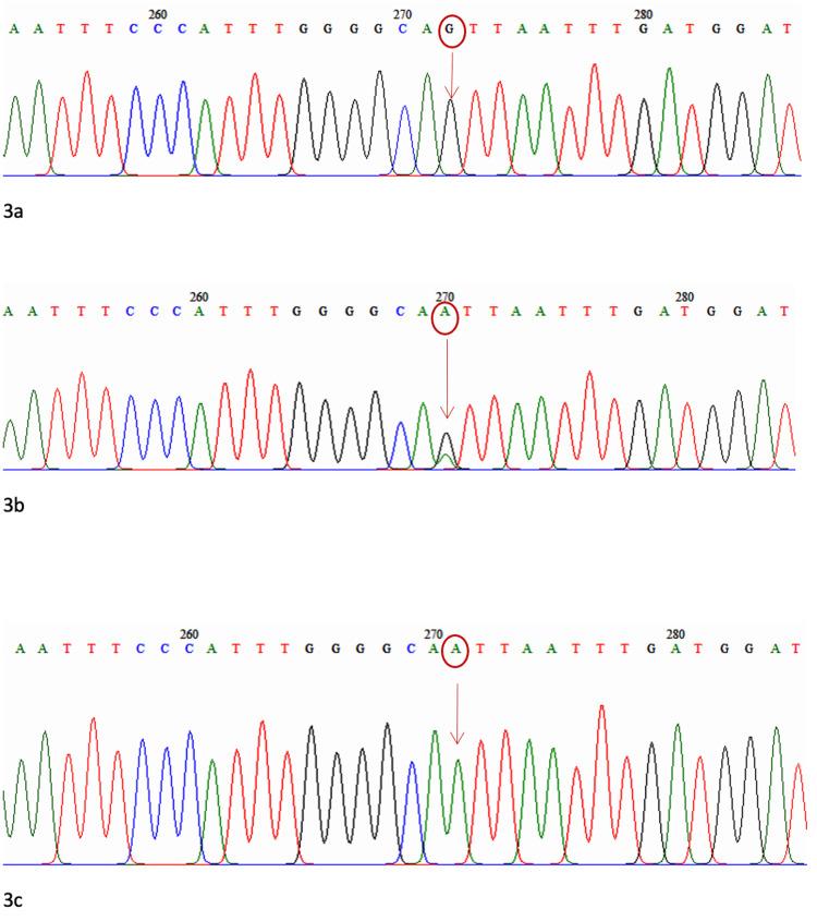 https://cdn.ncbi.nlm.nih.gov/pmc/blobs/1686/8592120/0202b5669148/cureus-0013-00000018823-i03.jpg