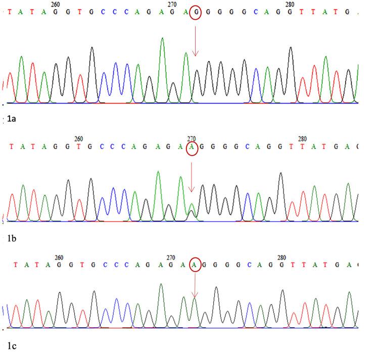 https://cdn.ncbi.nlm.nih.gov/pmc/blobs/1686/8592120/06e2881142b0/cureus-0013-00000018823-i01.jpg