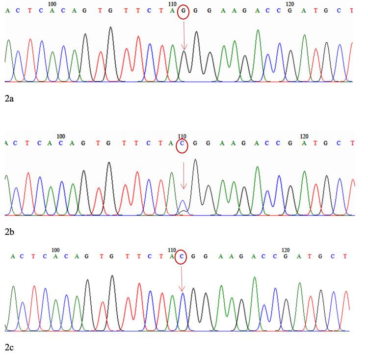 https://cdn.ncbi.nlm.nih.gov/pmc/blobs/1686/8592120/4e981938a677/cureus-0013-00000018823-i02.jpg