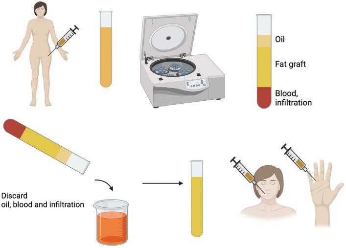 https://cdn.ncbi.nlm.nih.gov/pmc/blobs/1687/11941144/49756c9a5e3b/cells-14-00458-g001.jpg