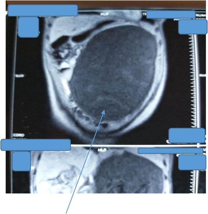 https://cdn.ncbi.nlm.nih.gov/pmc/blobs/168c/7672251/01f852598d75/gr2.jpg