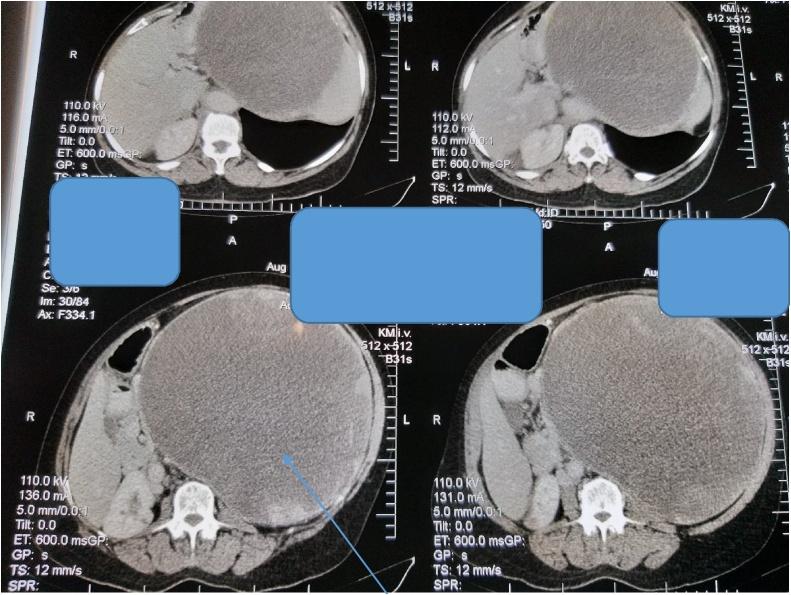 https://cdn.ncbi.nlm.nih.gov/pmc/blobs/168c/7672251/84ac85b61ab4/gr8.jpg