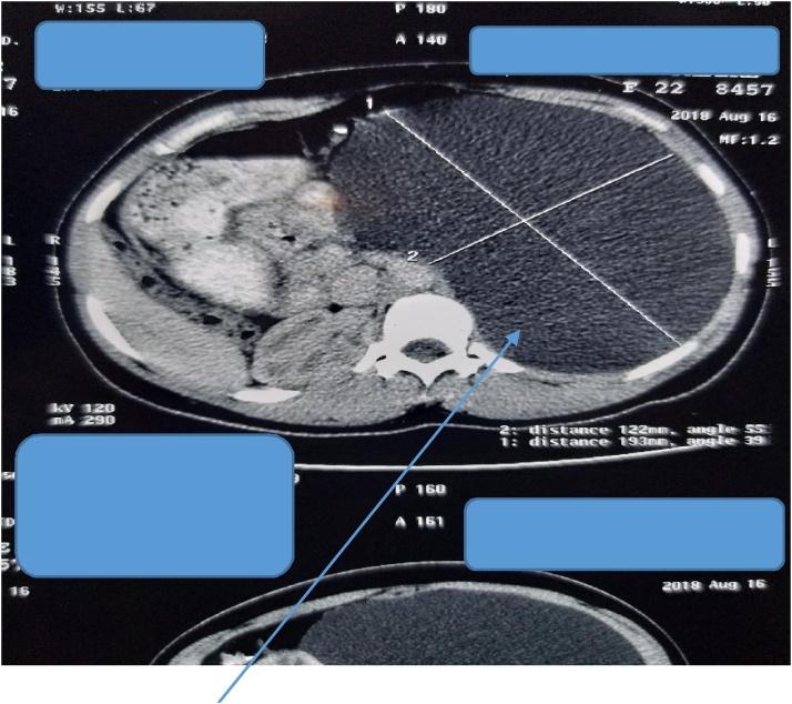 https://cdn.ncbi.nlm.nih.gov/pmc/blobs/168c/7672251/f3be0688b974/gr1.jpg