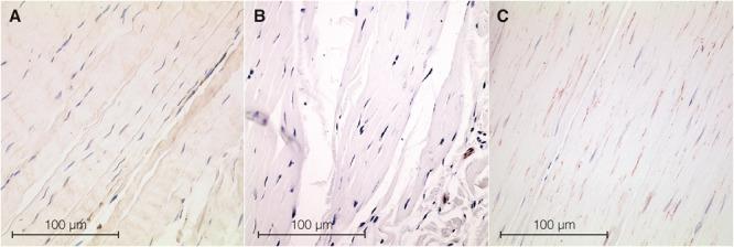 https://cdn.ncbi.nlm.nih.gov/pmc/blobs/1694/6455047/009cd83b134b/fphys-10-00336-g002.jpg