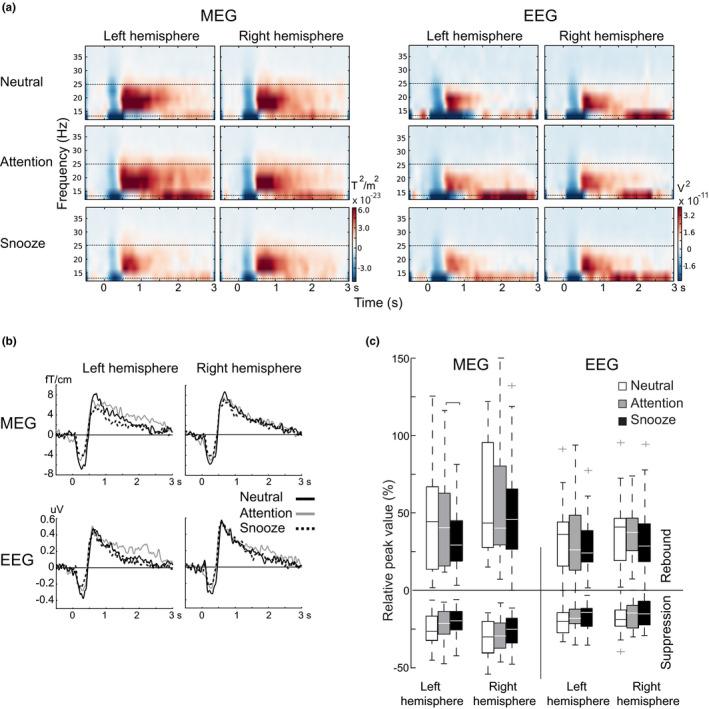 https://cdn.ncbi.nlm.nih.gov/pmc/blobs/1694/8234481/c4542b86e40c/PHY2-9-e14818-g002.jpg