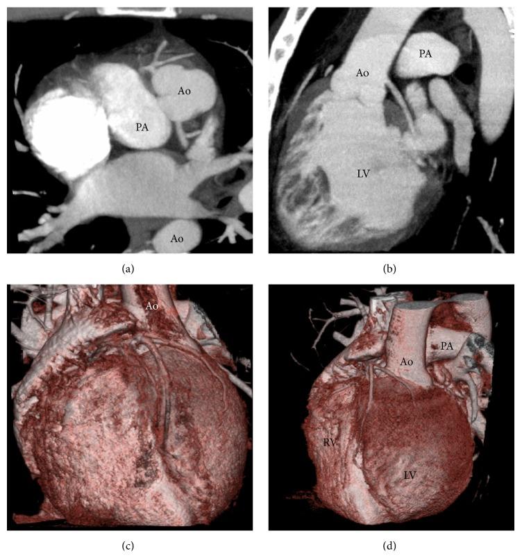 https://cdn.ncbi.nlm.nih.gov/pmc/blobs/169a/4736807/b4781348d09e/CRIC2016-5482578.002.jpg