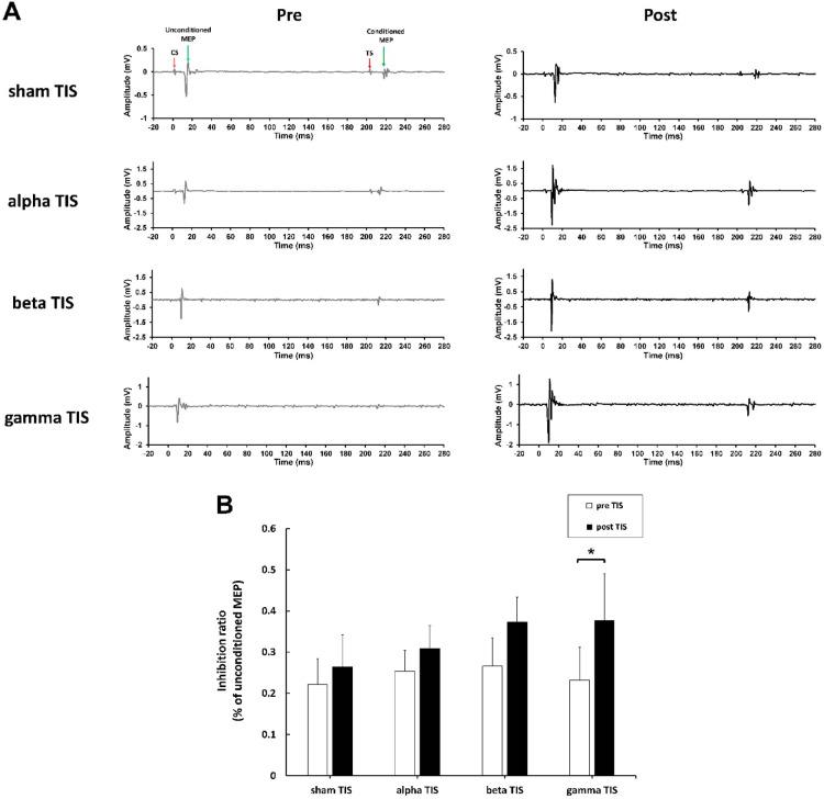 https://cdn.ncbi.nlm.nih.gov/pmc/blobs/16a0/12081686/b1034f7c77ba/41598_2025_1008_Fig6_HTML.jpg