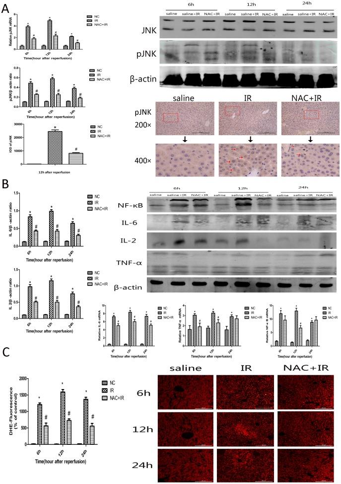 https://cdn.ncbi.nlm.nih.gov/pmc/blobs/16a4/4181678/07d903983df6/pone.0108855.g004.jpg