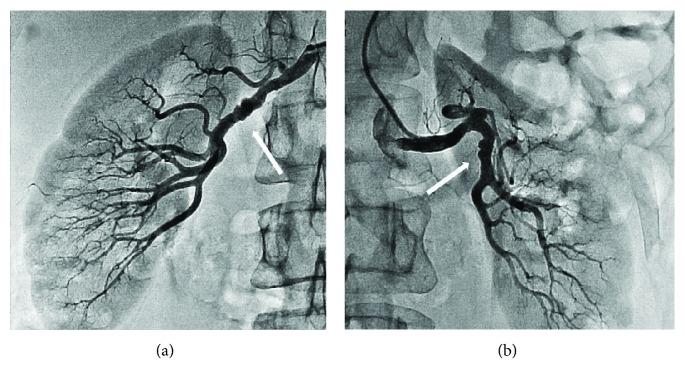 https://cdn.ncbi.nlm.nih.gov/pmc/blobs/16a6/6525919/69ae591fd9e9/CRIC2019-3051616.004.jpg