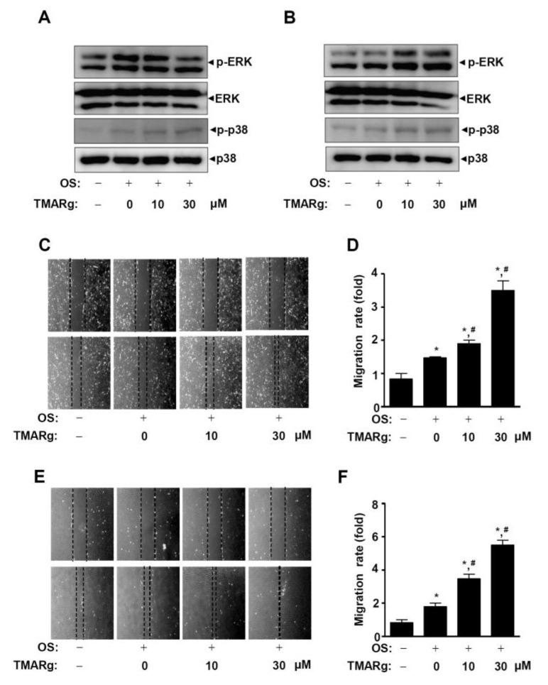https://cdn.ncbi.nlm.nih.gov/pmc/blobs/16ab/7432489/4d37fe7e6abd/ijms-21-05332-g006.jpg