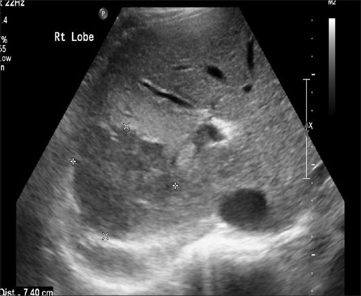 https://cdn.ncbi.nlm.nih.gov/pmc/blobs/16ae/6298363/853b20052b8c/SJMMS-5-189-g004.jpg
