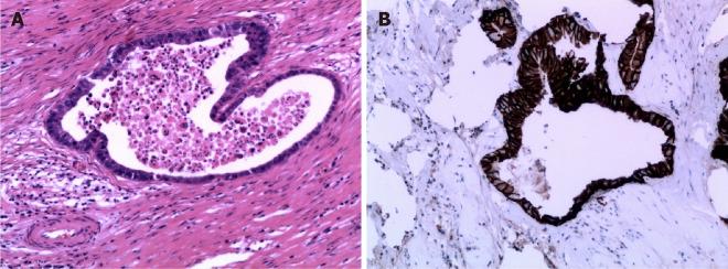 https://cdn.ncbi.nlm.nih.gov/pmc/blobs/16af/8040168/49cad870c026/WJCC-9-2542-g005.jpg