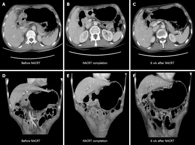 https://cdn.ncbi.nlm.nih.gov/pmc/blobs/16af/8040168/9c9c84bbff41/WJCC-9-2542-g003.jpg