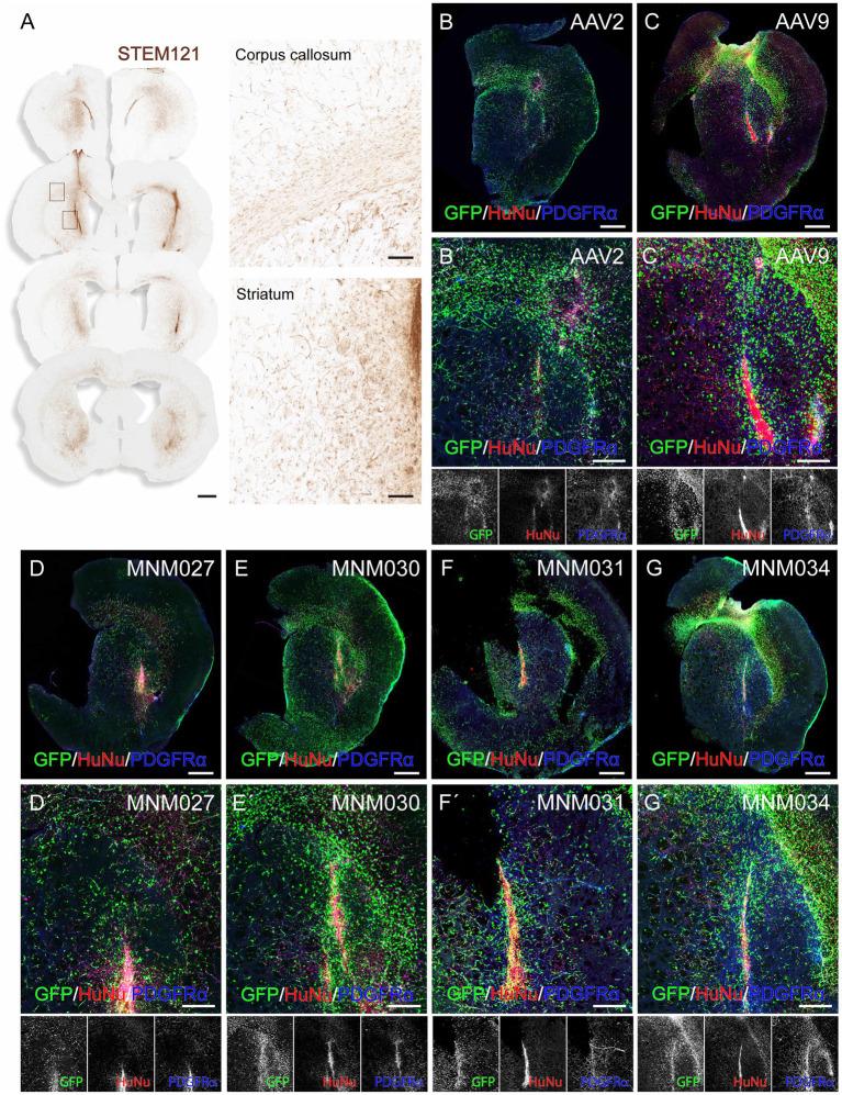 https://cdn.ncbi.nlm.nih.gov/pmc/blobs/16b6/11348808/3adaf95da8f9/fnins-18-1435212-g003.jpg