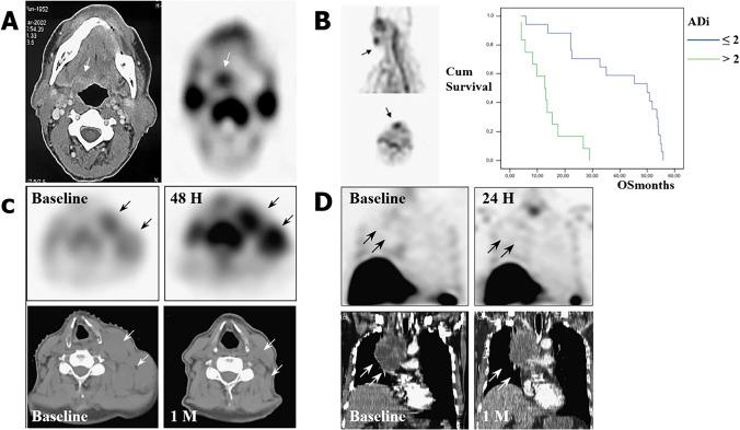 https://cdn.ncbi.nlm.nih.gov/pmc/blobs/16c2/8921127/816152431f4c/259_2021_5641_Fig5_HTML.jpg
