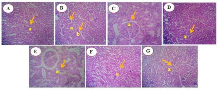 https://cdn.ncbi.nlm.nih.gov/pmc/blobs/16c5/11673636/6719a8c28686/antioxidants-13-01513-g014.jpg