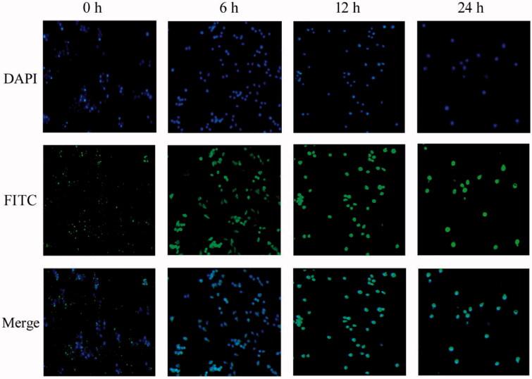 https://cdn.ncbi.nlm.nih.gov/pmc/blobs/16c6/8205034/d7e0c9ff63da/IDRD_A_1934189_F0004_C.jpg