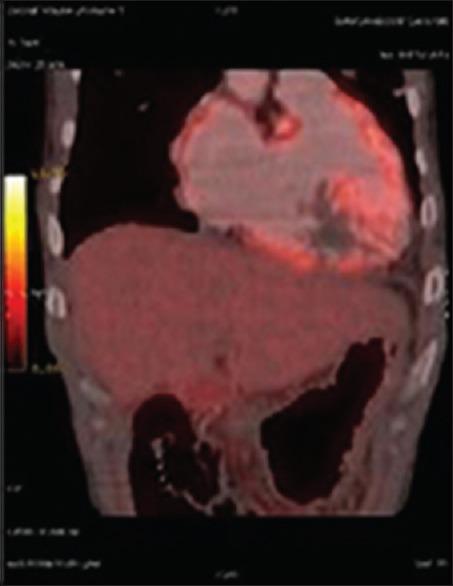 https://cdn.ncbi.nlm.nih.gov/pmc/blobs/16c9/5504903/b873aaf682aa/LI-34-395-g003.jpg