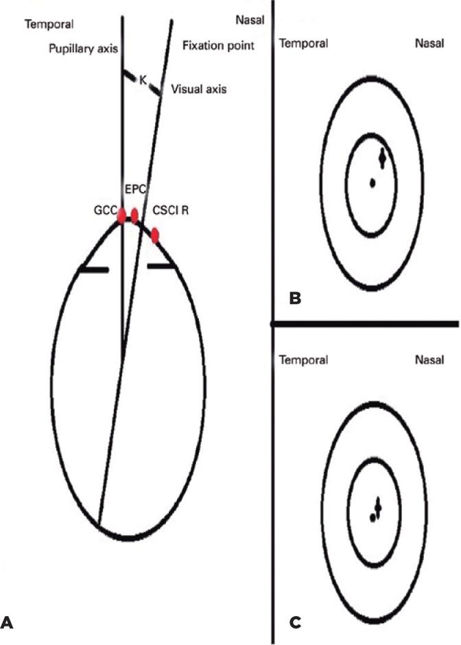 https://cdn.ncbi.nlm.nih.gov/pmc/blobs/16ce/11984437/c9296e58b035/abo-83-01-0076-g02.jpg