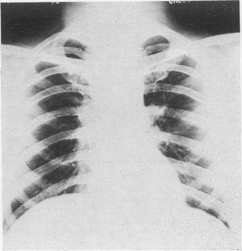 https://cdn.ncbi.nlm.nih.gov/pmc/blobs/16db/2467334/0803188708da/postmedj00347-0018-a.jpg