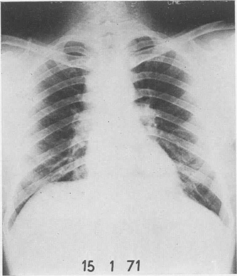 https://cdn.ncbi.nlm.nih.gov/pmc/blobs/16db/2467334/4f69be500e8d/postmedj00347-0019-a.jpg