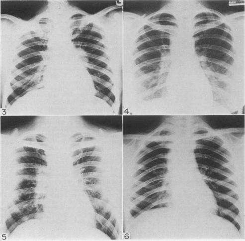 https://cdn.ncbi.nlm.nih.gov/pmc/blobs/16db/2467334/8f013a2b8fcb/postmedj00347-0015-a.jpg