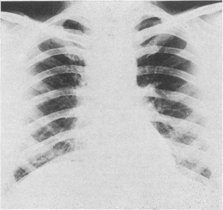 https://cdn.ncbi.nlm.nih.gov/pmc/blobs/16db/2467334/a07590cce29e/postmedj00347-0018-b.jpg