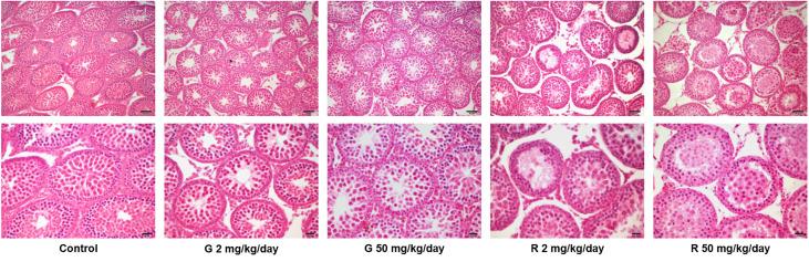 https://cdn.ncbi.nlm.nih.gov/pmc/blobs/16df/7992013/4569e9015c21/fendo-12-615678-g002.jpg