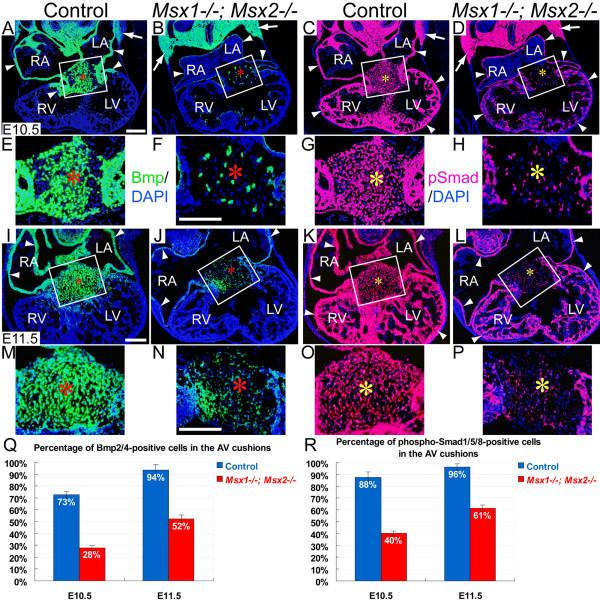 https://cdn.ncbi.nlm.nih.gov/pmc/blobs/16e4/2518925/004bd09a2225/1471-213X-8-75-5.jpg