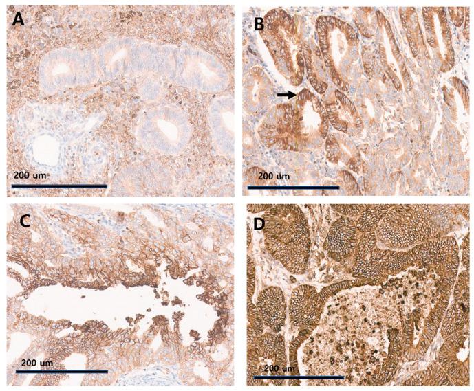 https://cdn.ncbi.nlm.nih.gov/pmc/blobs/16e7/11353210/15143cfa2cef/diagnostics-14-01735-g001.jpg