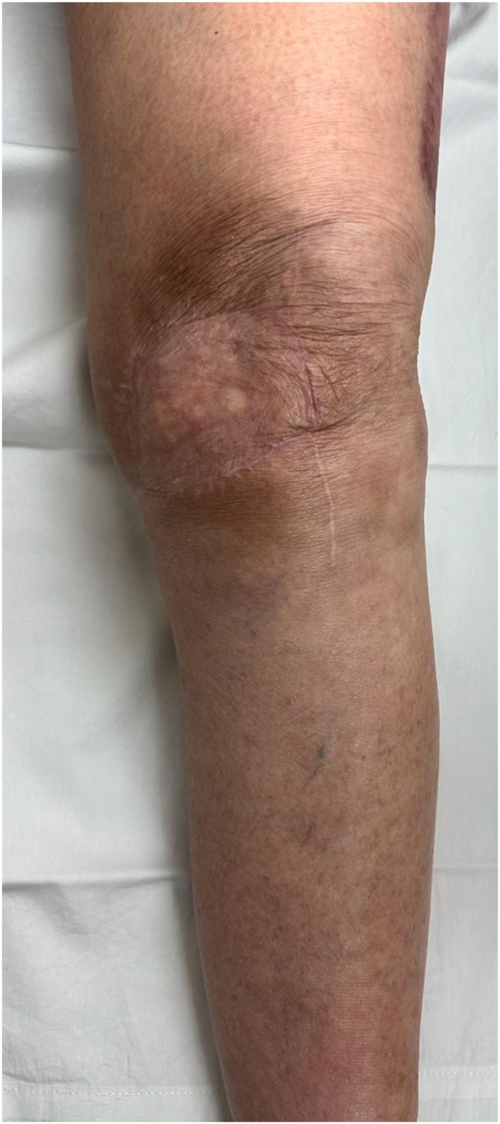 https://cdn.ncbi.nlm.nih.gov/pmc/blobs/16e9/12179722/25649c1eb4f3/gr2.jpg