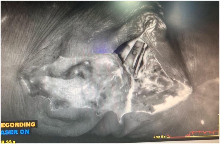 https://cdn.ncbi.nlm.nih.gov/pmc/blobs/16e9/12179722/ce7215894eb6/gr4.jpg