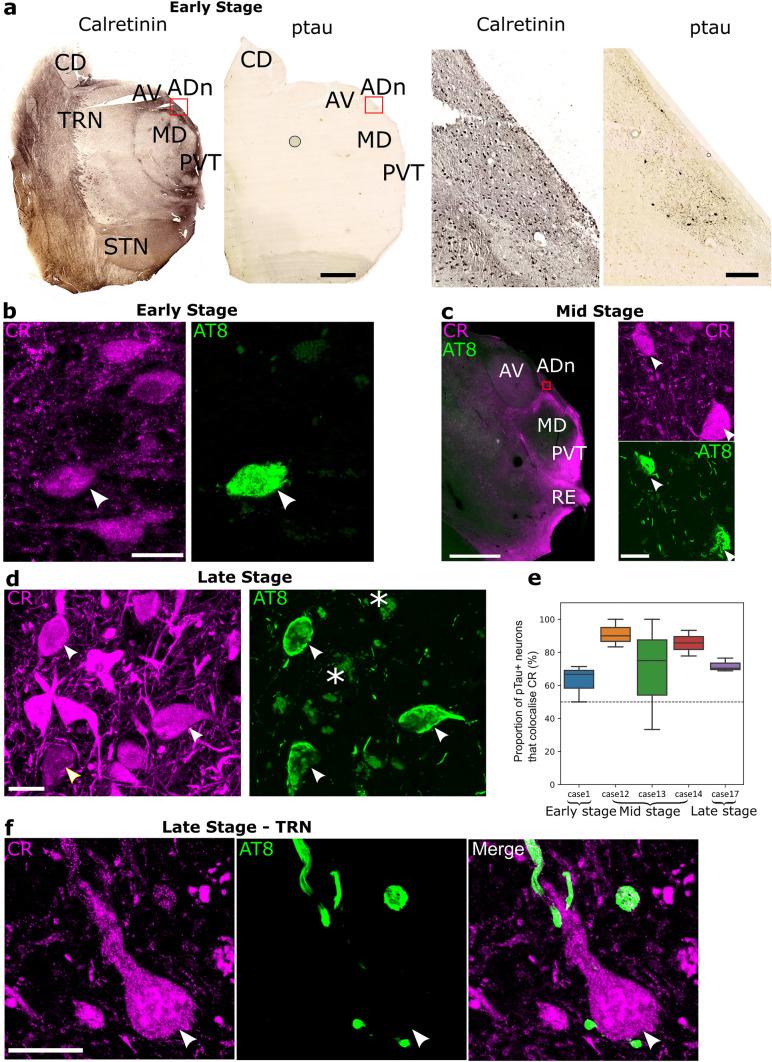 https://cdn.ncbi.nlm.nih.gov/pmc/blobs/16f1/11166832/63d1cc3d922a/401_2024_2749_Fig4_HTML.jpg