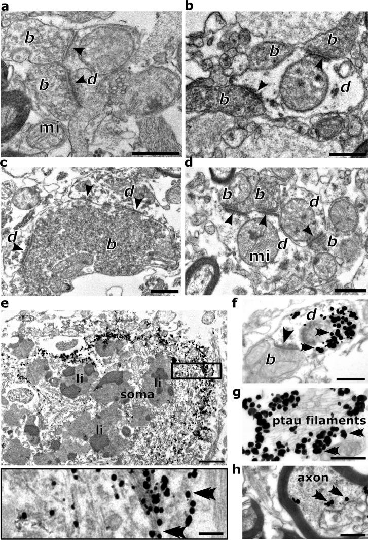 https://cdn.ncbi.nlm.nih.gov/pmc/blobs/16f1/11166832/c7cd03e3cfd1/401_2024_2749_Fig5_HTML.jpg