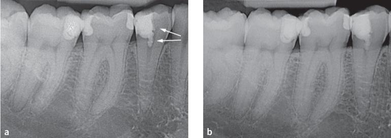 https://cdn.ncbi.nlm.nih.gov/pmc/blobs/16f3/11619879/ad23e531653a/ohpd-21-331-g001.jpg