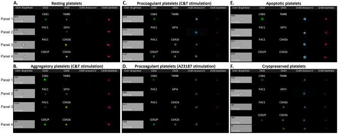 https://cdn.ncbi.nlm.nih.gov/pmc/blobs/16f3/9867743/d2fb6351bdf4/41598_2023_28352_Fig3_HTML.jpg