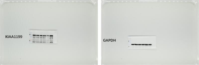 https://cdn.ncbi.nlm.nih.gov/pmc/blobs/16fe/11357851/887f874a4108/fx1.jpg