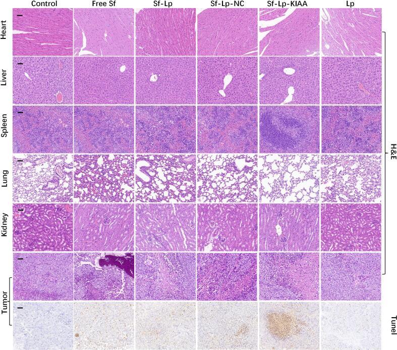 https://cdn.ncbi.nlm.nih.gov/pmc/blobs/16fe/11357851/fd3e2a50e2b4/gr10.jpg