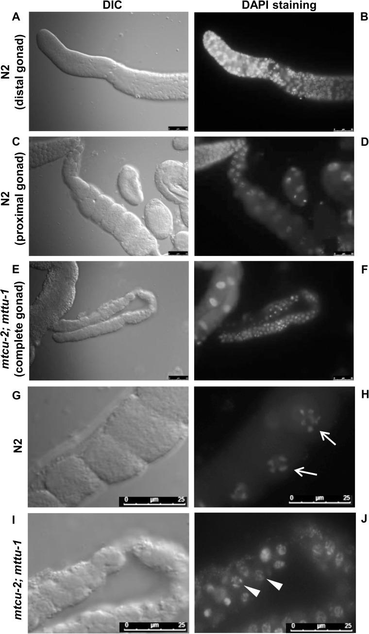 https://cdn.ncbi.nlm.nih.gov/pmc/blobs/1700/5544249/af0307af40fc/pgen.1006921.g010.jpg
