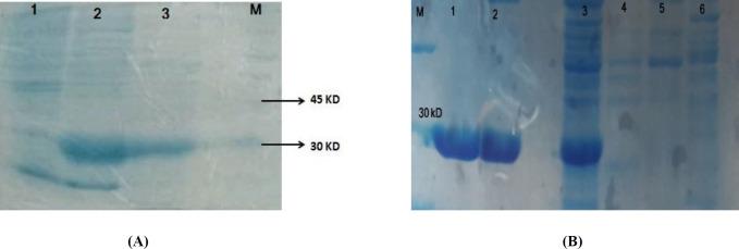 https://cdn.ncbi.nlm.nih.gov/pmc/blobs/1706/7757975/d3189043b1f7/ijpr-19-206-g002.jpg