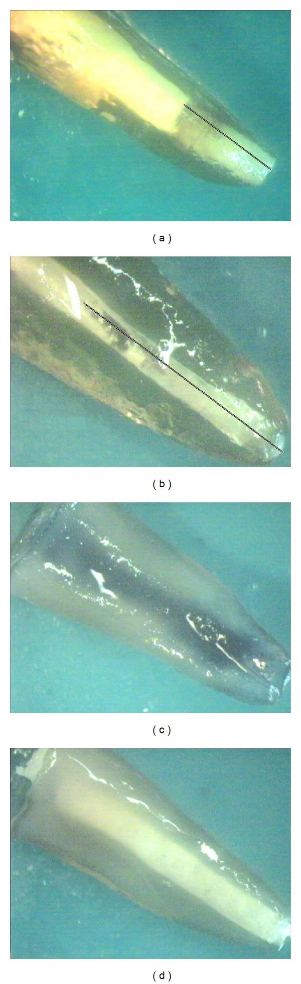 https://cdn.ncbi.nlm.nih.gov/pmc/blobs/1707/3826560/a25466b21283/ISRN.DENTISTRY2013-959813.001.jpg