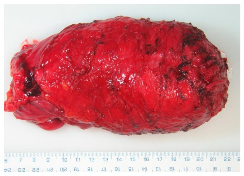 https://cdn.ncbi.nlm.nih.gov/pmc/blobs/1709/12427191/3057ea4123f6/cancers-17-02820-g003.jpg