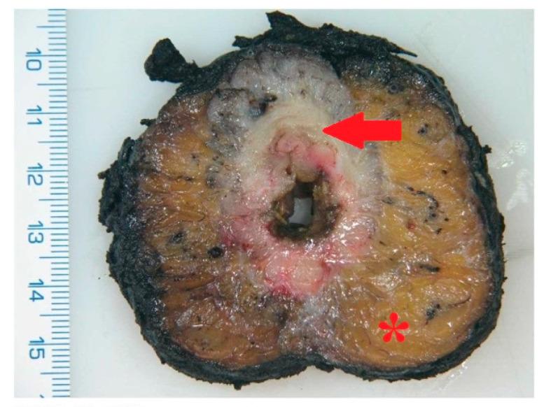 https://cdn.ncbi.nlm.nih.gov/pmc/blobs/1709/12427191/5d2f558c40a6/cancers-17-02820-g004.jpg